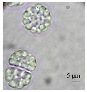 圖12. Aurantiochytrium limacinum（不知道中文叫什么，可以看到細(xì)胞里一個(gè)個(gè)油滴，by Abad &Turon, 2015）